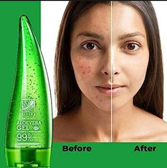 Korean Pure Aloe Vera Gel 120ml – 99% Soothing Gel for Face, Skin & Hair