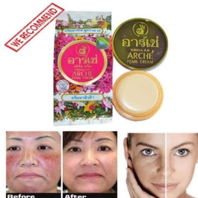 Pack Of 4 Beauty Cream Arche Pearl Beauty Cream – Whitening & Moisturizing Cream | Removes Acne, Freckles, Dark Spots & Wrinkles