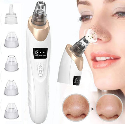 5-in-1 Blackhead Remover Vacuum – Electric Pore Cleaner & Acne Extractor for Deep Facial Cleansing