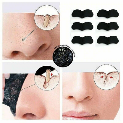 5pcs Nose Blackhead Remover
