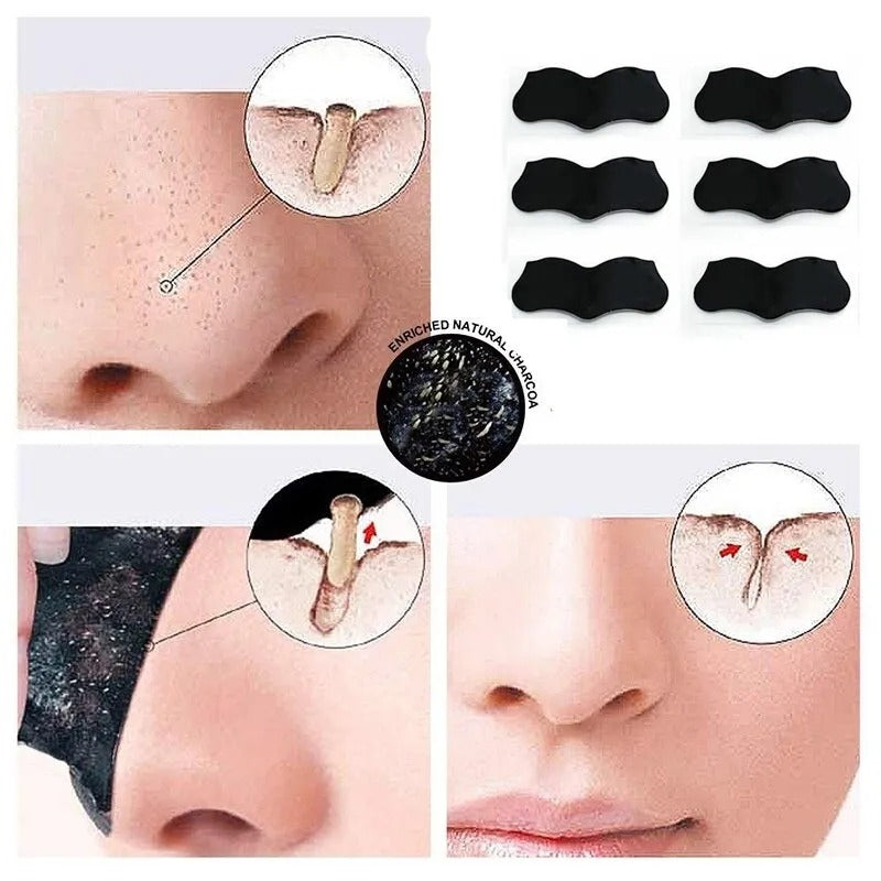 Blackhead Removal Nose Strips