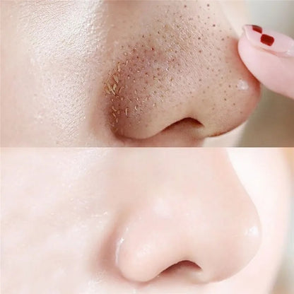 Blackhead Removal Nose Strips