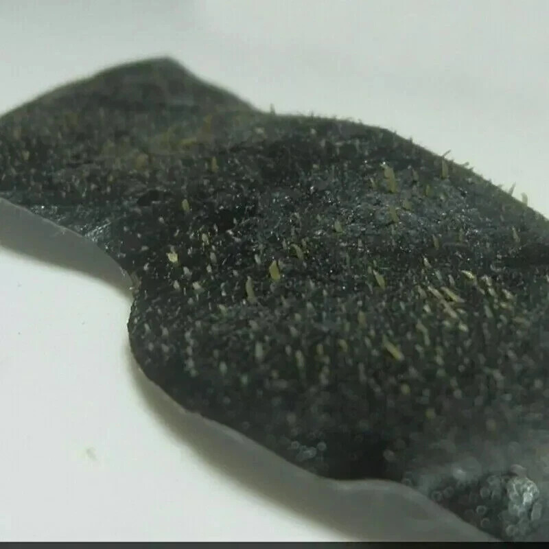 5pcs Nose Blackhead Remover