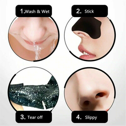 5pcs Nose Blackhead Remover